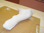 Bi-valve casting technique for irregular shaped limb. Maximum accuracy. - Garrison's Prosthetic Services