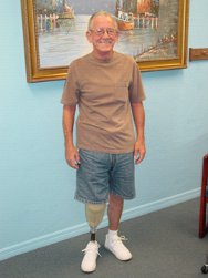 Dycor Single Axis lightweight prosthesis for trans-tibial amputation constructed by Kevin S. Garrison C.P., L.P. - Garrison's Prosthetic Services